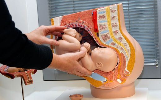 A model of how a baby is located in the womb. Photo ANP, Ilvy Njiokoktjien

