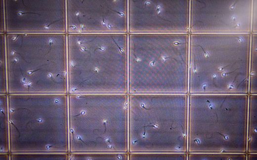 Research of human sperm in a laboratory. Photo AFP, Yuichi Yamazaki