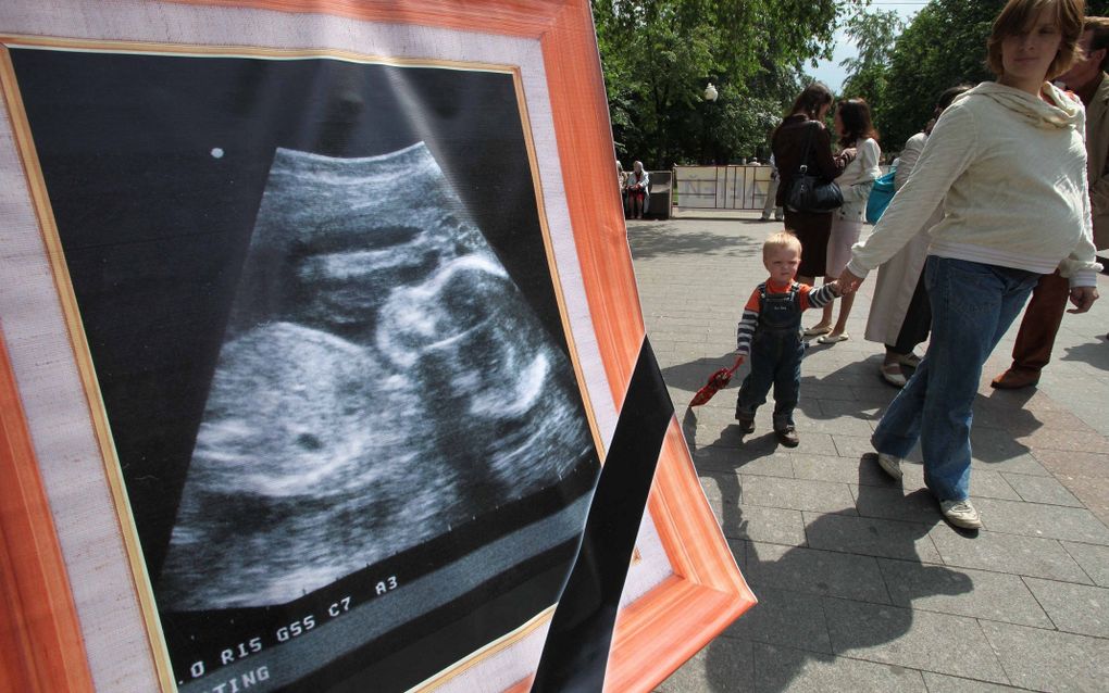 Regions in Russia started to ban abortion. Is a national ban realistic? 