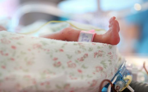 A newborn baby lies in an incubator. Photo EPA, Lukasz Gagulski 