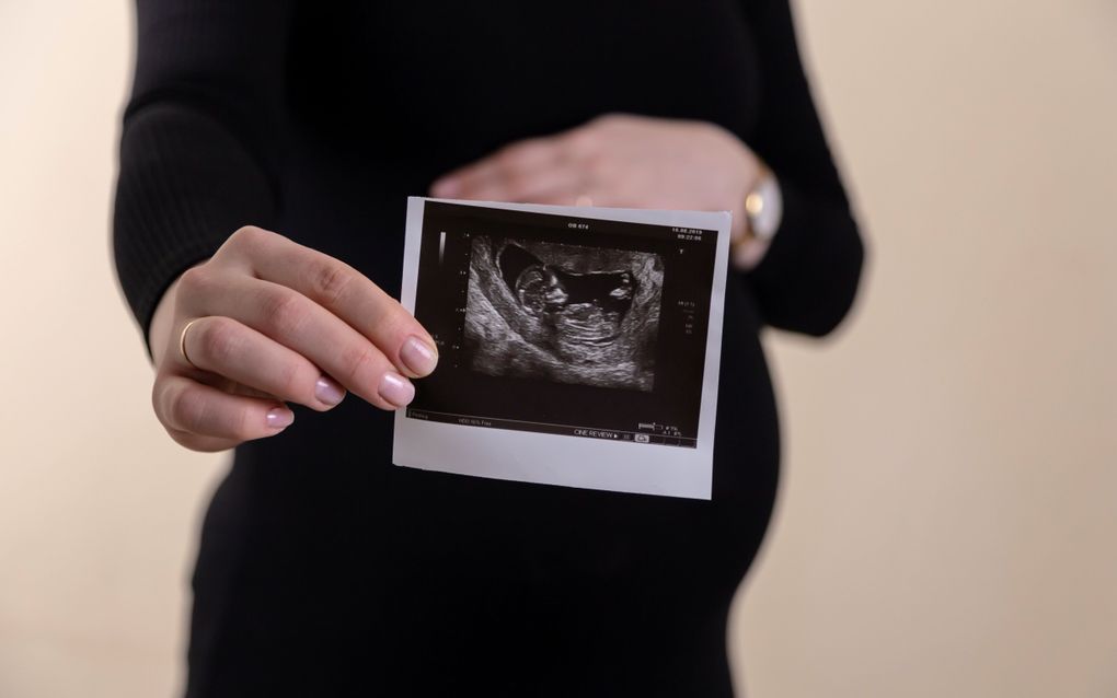 Dutch experts critical of Dutch expansion prenatal screening 